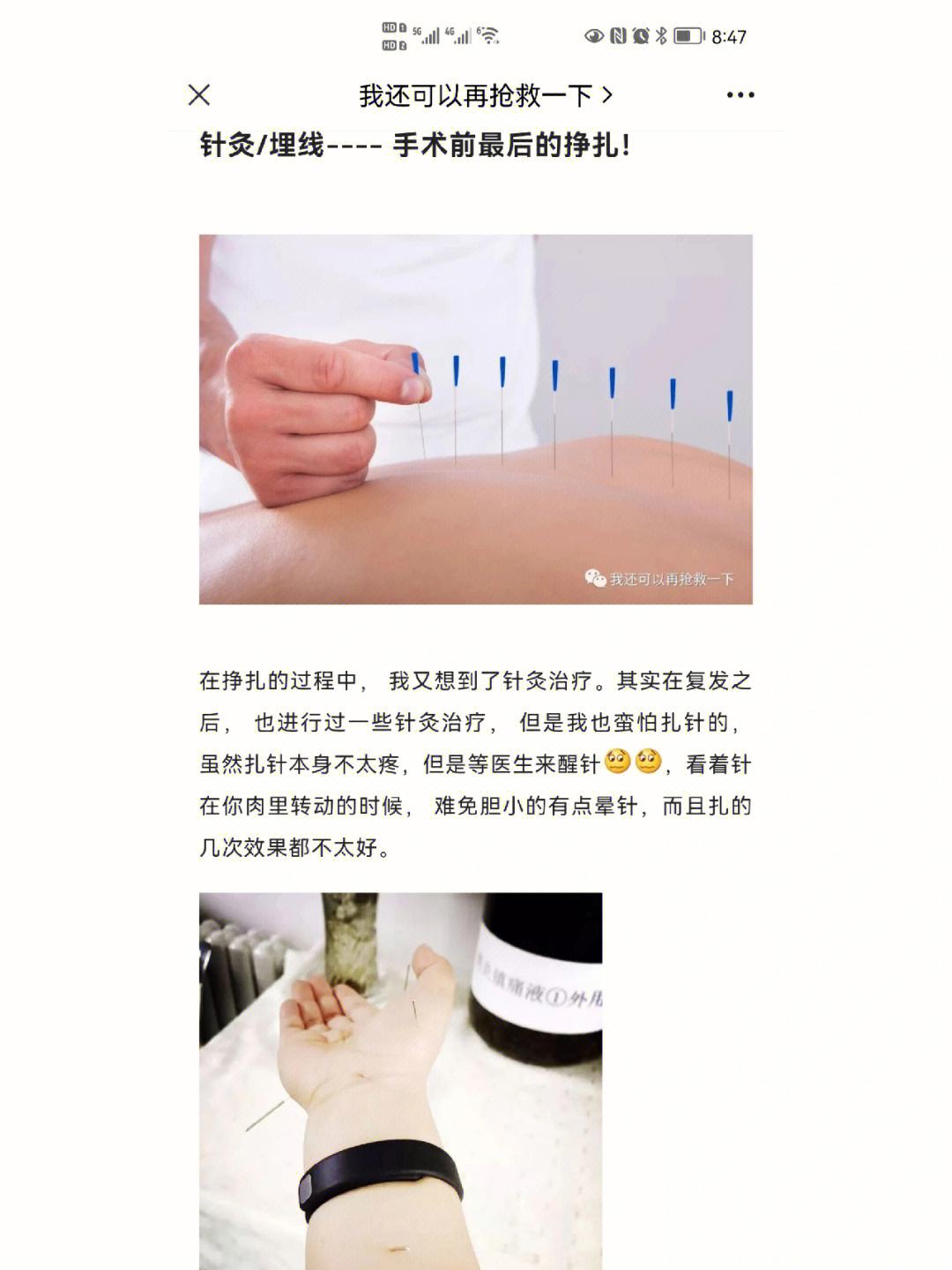 针灸腰肌视频讲解教程下载-(针灸教学视频140集免费下载)